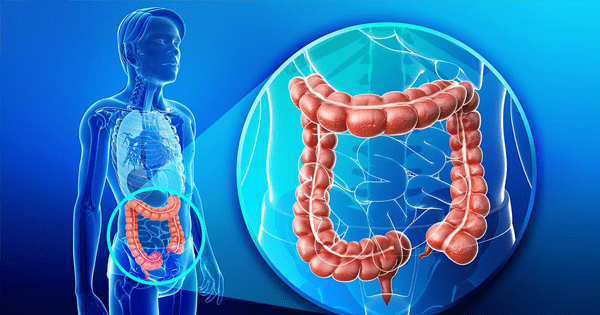 Detectar el cáncer de colon Detectar el cáncer de colon