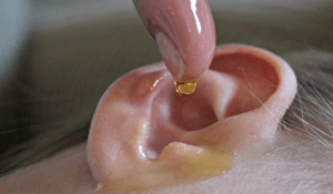Eliminar la cera de oídos con remedios caseros