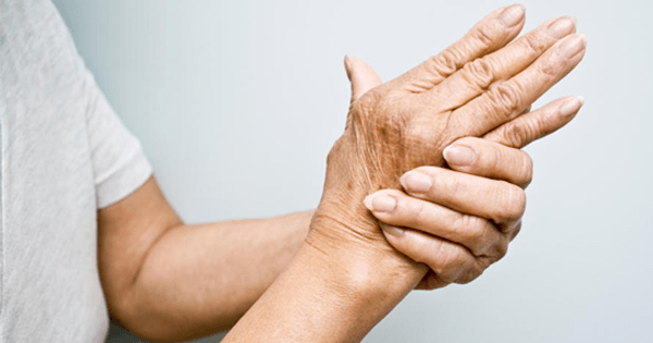 Causas de la artritis reumatoide