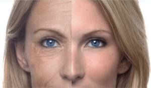Factores que envejecen la piel