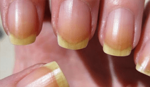Señales de las uñas de las manos para tu salud