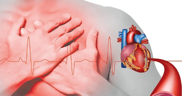 ¿cómo Se Diagnostica La Existencia De Cardiopatía Isquémica Consejos