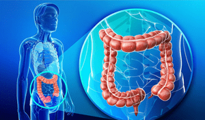 ¿Cómo detectar el cáncer de colon?